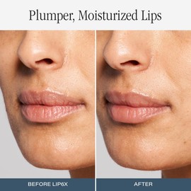 Skinn Cosmetics Lip6X