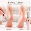 Rechargeable Electric Foot File for Heel Care – 2-Speed Callus