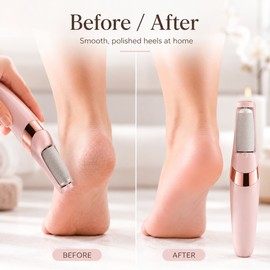 Rechargeable Electric Foot File for Heel Care – 2-Speed Callus Remover with Fine and Coarse Roller Heads