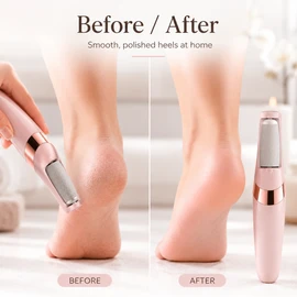 Rechargeable Electric Foot File for Heel Care – 2-Speed Callus Remover with Fine and Coarse Roller Heads