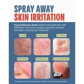 Daybreak Mighty Mist Skincare - Skin Repair Treatment for All Skin Types - Hypochlorous Acid Spray for Acne, Rosacea - Size: 1 oz (30 ml)