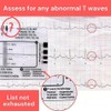ZENWORYS 2pcs ECG 7 Step Ruler,ECG 7 Step Ruler for