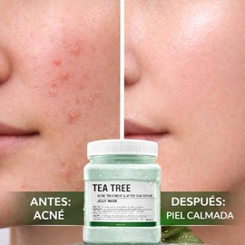 Mascarilla Jelly de Tea Tree para Rostro, Cuidado de Piel Grasa y con Imperfecciones, Efecto Refrescante y Calmante, Hidratación Facial