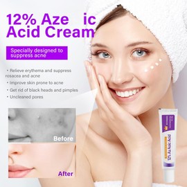12% Acid Spot Cream - Acne Treatment - Acne Cream for Spot Prone Skin - Anti, Rosacea for Face,Pimple Crea-m,Dark Spo-t Remover - Pimple cream Face Moisturiser - Even Skin Tone