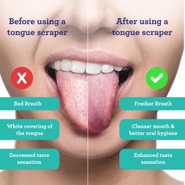 GuruNanda Rascador de lengua (paquete de 2), rascador de lengua de acero inoxidable para higiene bucal, tratamiento de mal aliento, limpiador de lengua 100% acero inoxidable de grado médico con estuche de viaje para adultos y niños
