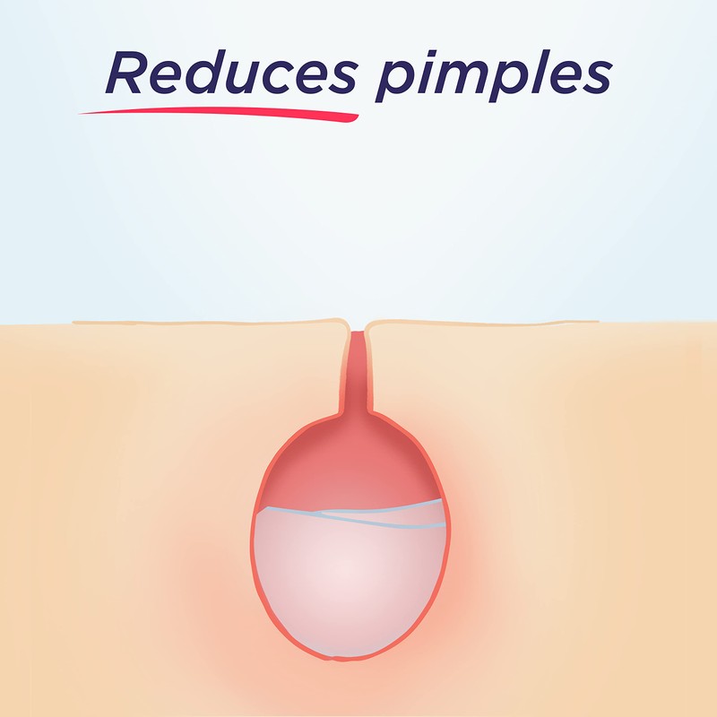 Clearasil Deep Cleansing Pads Extra Strength