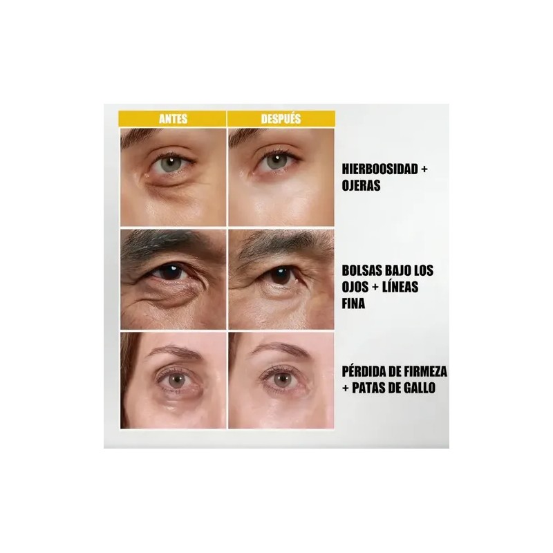 Crema Contorno De Ojos Fsfn Anti-pigment Anti-ojeras 15ml