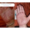 Salcura Bioskin Zeoderm Pack of 1 x 50 ml