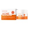 Crema Para El Tratamiento Del Acné Crema Facial Antiacné Pim
