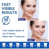 Tiras Blanqueadoras Dentales White Piezas Antideslizantes