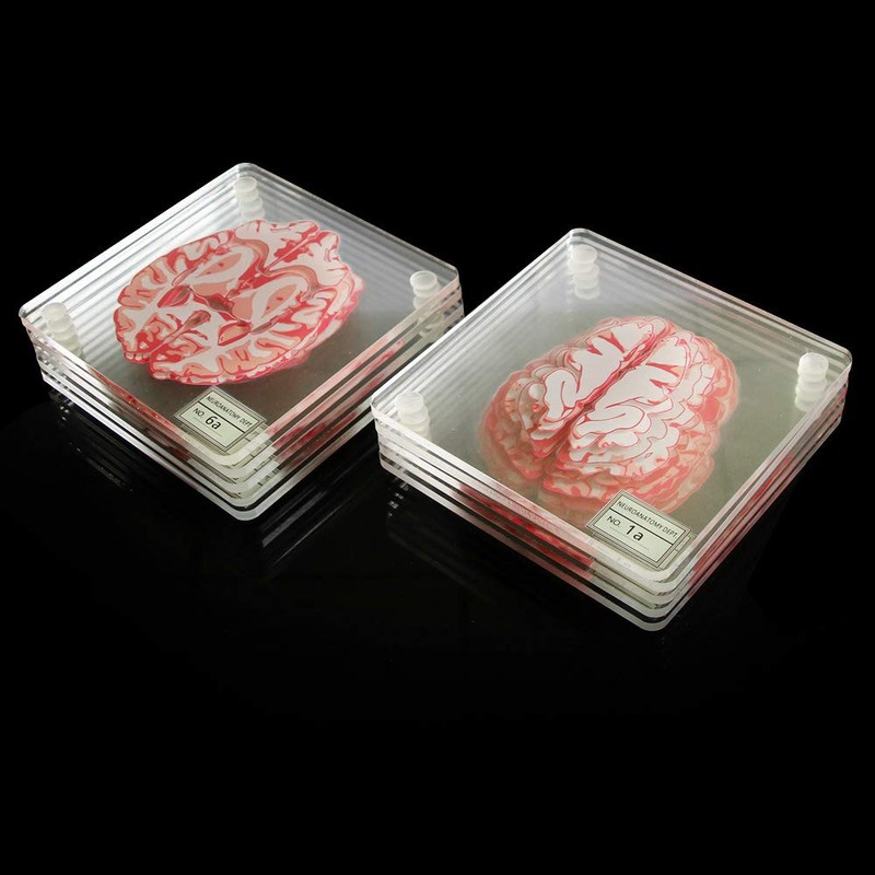 Timethink (Set of 10) 4'' 3D Brain Specimen Coasters, Funny