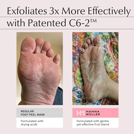 Advanced Foot Peeling Mask - Exfoliates Dry Skin - Cracked Heel Repair - TRIPLE AHA BLEND & Salicylic Acid - 5 BOTANICAL EXTRACTS - Vitamin C & A - 3 pairs