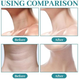 Body Moisturiser,Body Cream,Ultra Hydrating Skin Firming Cream For Arms,Body Lotion Women,Dry Skins Moisturiser,Neck Firm Creams,Tightening Cr-eam Bodys,Fir-ming Creams For Loose Skin