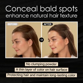 LALACHUU Hairline Powder, the revolutionary solution for concealing hair loss instantly, Root Touch Up for Women & Men with Master Brush. Stain Proof for 100 hours 0.52 Ounce (Natural Black)