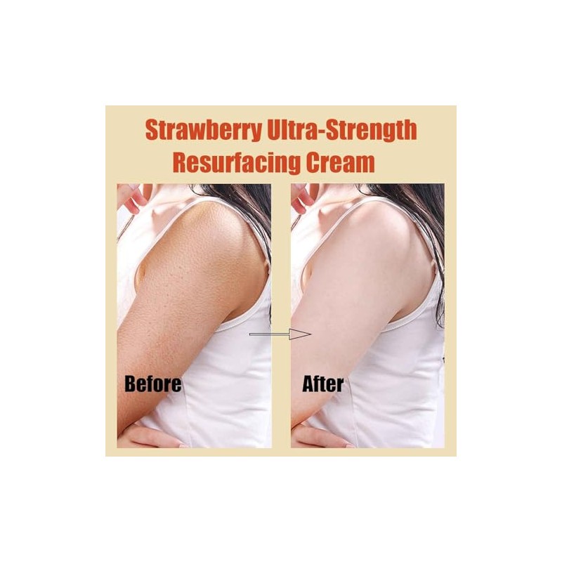 Piezas Crema Rejuvenecedora Piel Fresa Loción Piernas Mujeres Reduce Protuberancias