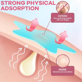 JEYORZY 336 Counts Pimple Patch, Pickel Patch Sterne Pimple Patches, Hydrokolloid Pickel Patch, Pimple Patches Star, Star Pimple Patch, Pickel Patch Set, Für alle Hauttypen geeignet