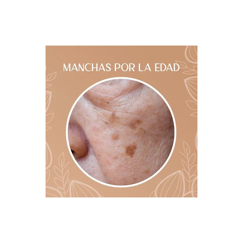 Crema Despigmentante Para Manchas, Melasma, Acné Y Paño