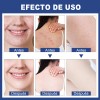 Sérum Antiacné Reductor De Espinillas Y Granos