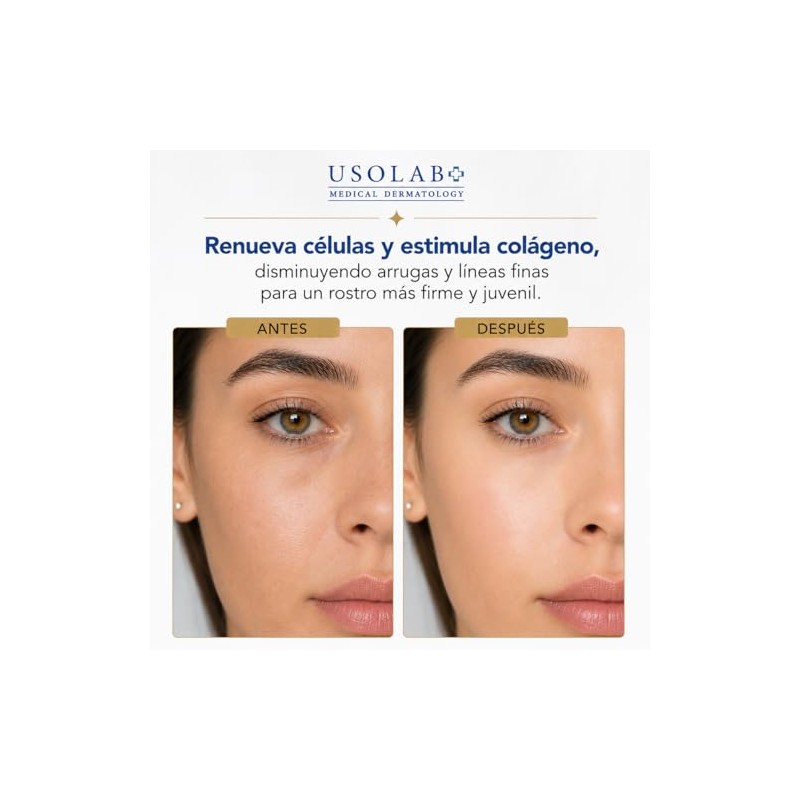Crema Facial Coreana Retinol Ácido Hialurónico Niacinamida Antiedad Reducir Arrugas