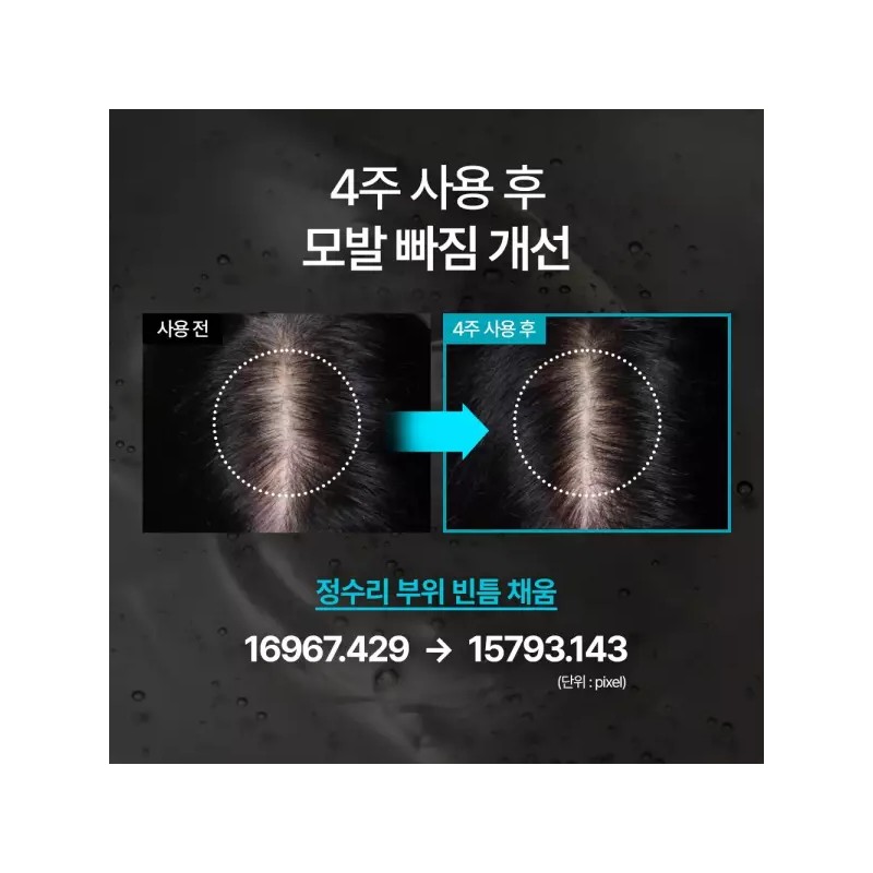 Blackbean 블랙빈 탈모증상개선 집중 앰플 Black Bean Hair Loss Improvement