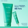 Skinfix Acne+ BHA Cleanser: Multi-Level Pore Resurfacing, Deep Pore &