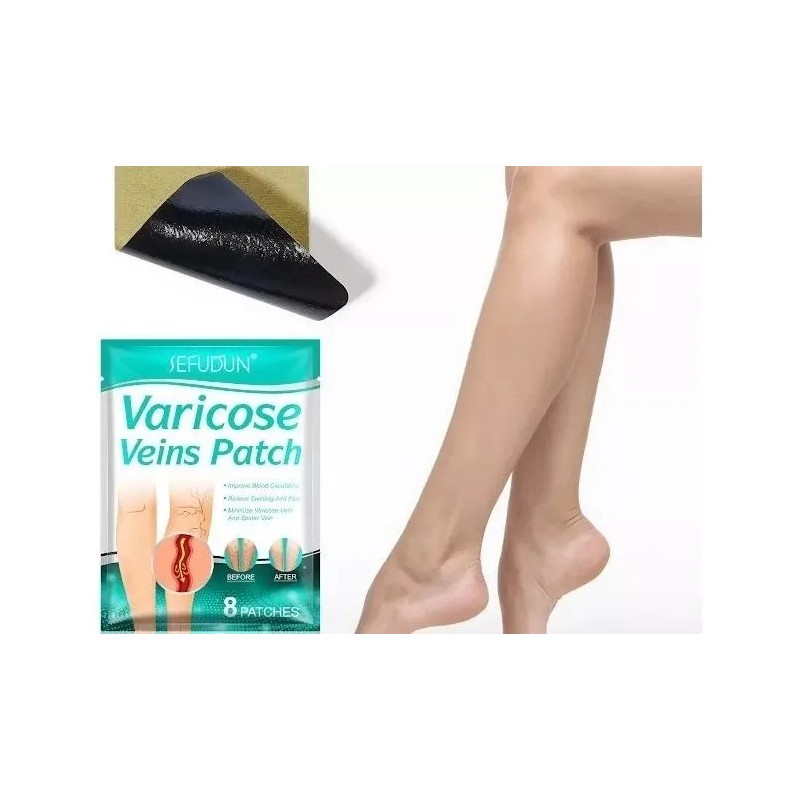 Parche para Aliviar el Dolor de Venas Varicosas y Varices