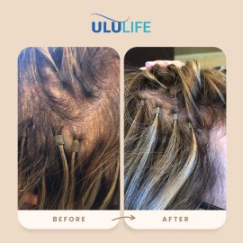 Ululife Multivitamínico Para Crecimiento Capilar 90 Cápsulas