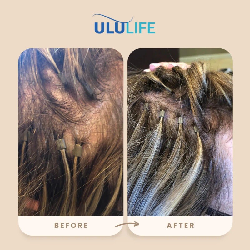 Ululife Multivitamínico Para Crecimiento Capilar 90 Cápsulas