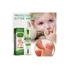 Tratamiento For Morderse Las Uñas For Niños Ls8q Stop.