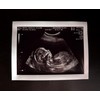 Prank 2D Customized Fake Ultrasound Single Photo ONLY NO Gender