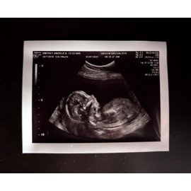 Prank 2D Customized Fake Ultrasound Single Photo ONLY NO Gender