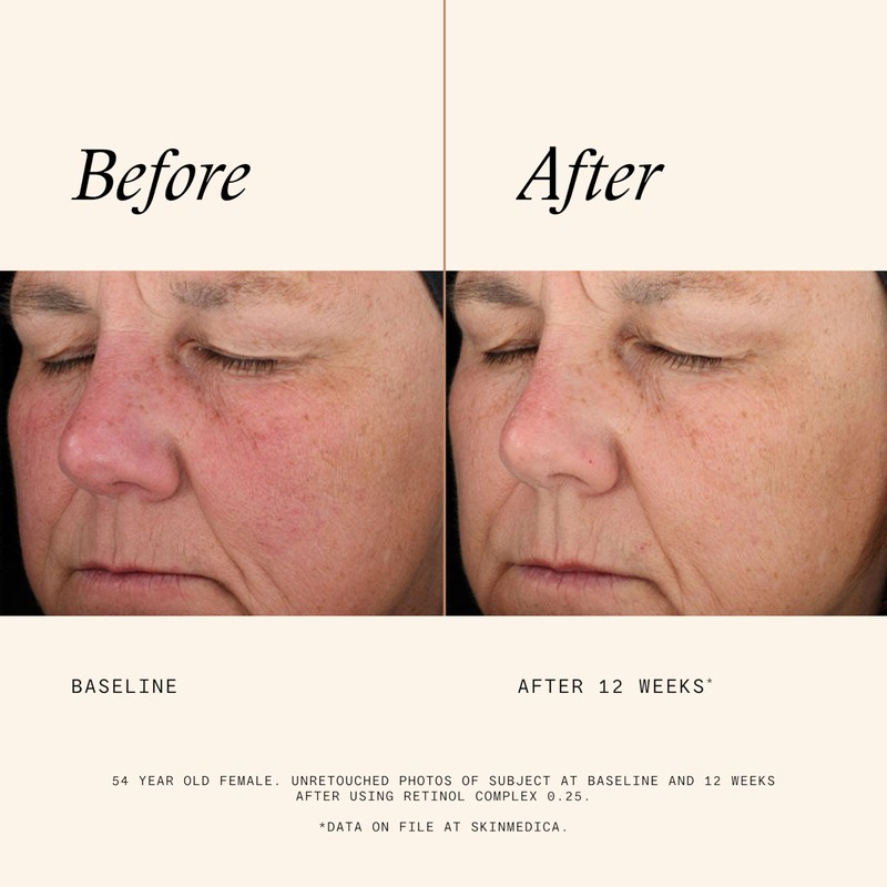 SkinMedica Retinol 0.25 Complex - Retinol Serum for Face, Age-Defying