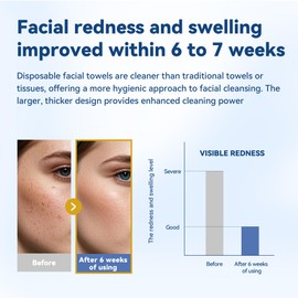 Welsteepse Clean Towels XL Disposable Face Towelettes, Makeup Remover Dry Wipes, Ultra Soft, 100% Biobased 100PCS