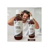 Shampoo Anticaida Resultados Reales Desde La Primer Semana