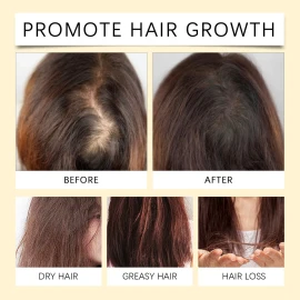 Aceite De Batana For El Crecimiento Del Cabello Con 100ml