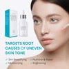 Dark Spot Corrector Remover for Face and Body, Dark Spot