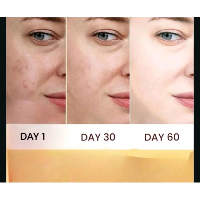 Roushun Koijc Acid + Vitamin C Body oils Brightenings for