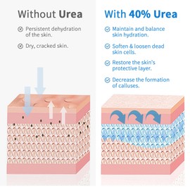 Urea Cream 40 Percent, Urea Foot & Hand Cream for Cracked Heels and Dry Skin, Urea Lotion for Deep Moisturizing, Callus Remover Nourishes Soften, Foot Moisturiser for Women&Men,Maximum Strength