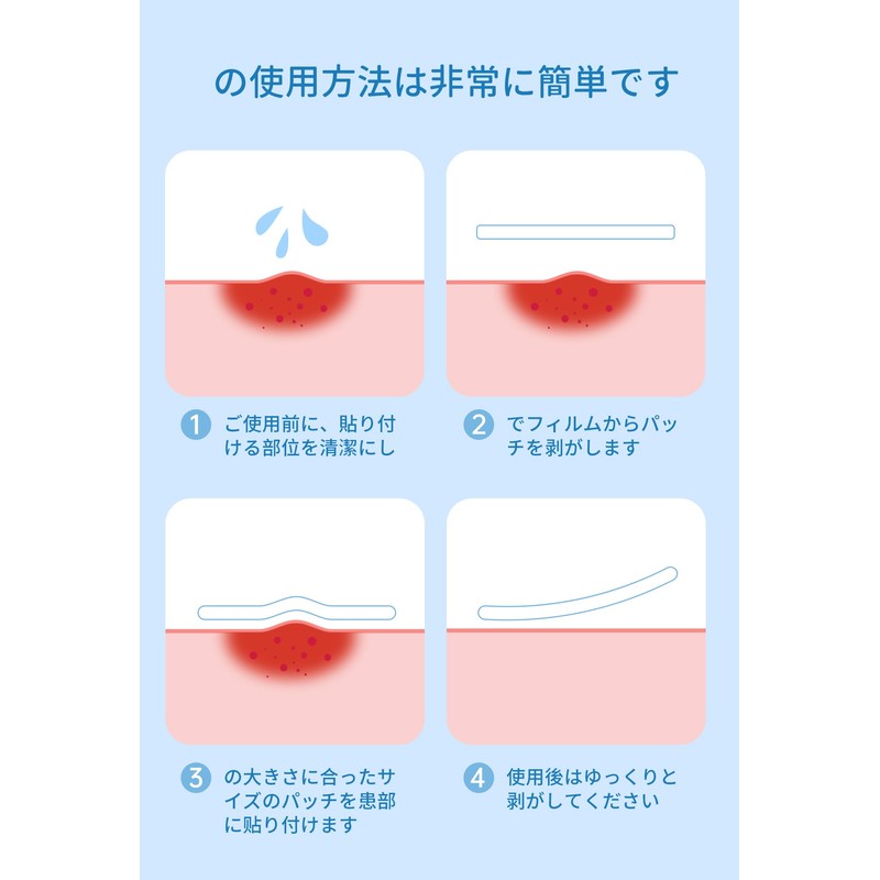 Patch, Point Patch, Day and Night, Unisex, Invisible, Won't Peel