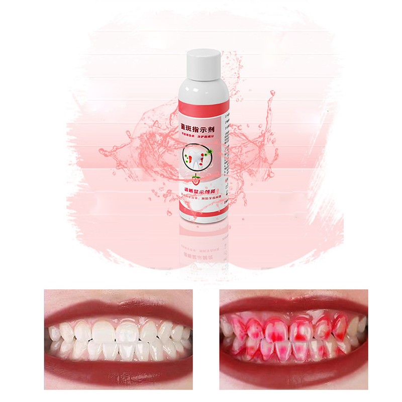 Plaque Disclosing Agent Oral Tartar Test Examination Dental Plaque Indicator