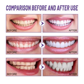 2PCS Gum Repair Gel,Revitalizes Gums and Instant Teeth Whitening Essence Pen,Gum Shield Therapygel,Protect Gums & Oral Care,Natural Toothpaste Treatment,Gum Regrowth for Receding Gums,Gum Treatment