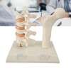 Osteoporosis Spine Model for Teaching and Demonstration, Visualize Bone Density
