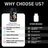 Dental Probiotics for Teeth and Gums - Best Lactobacillus Salivarius