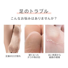 UQLIFE Electric Exfoliating Remover (Pink)