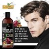 Generic Organic Onion Hair Growth Oil | Controls Hair Loss,