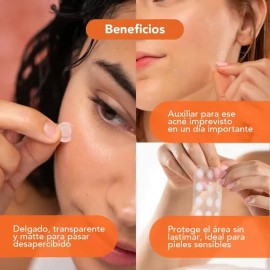 Alux Skin Parches Hidrocoloide Para Acné 30 Piezas Todo Tipo De Piel Díanoche                                                                         