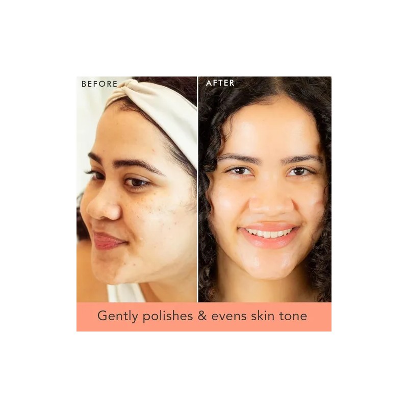 Exfoliante Y Limpiador Facial, Exfoliante Suave, Exfoliante