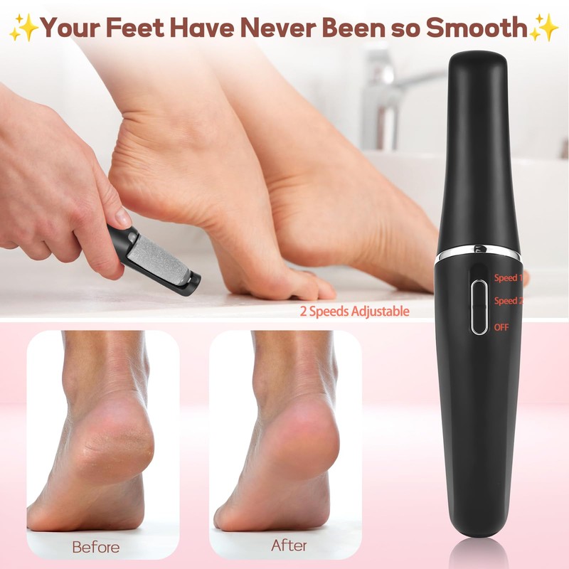 Callus Remover for Feet, ZABOUL Electric Foot Filer, Pedicure Tools