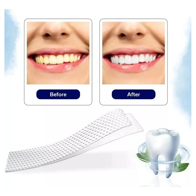 21 Piezas Tiras Bandas Blanqueadoras Tratamiento Dental 5d