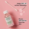 Mario Badescu AMPM Kit de imperfecciones, incluye tratamiento de acn